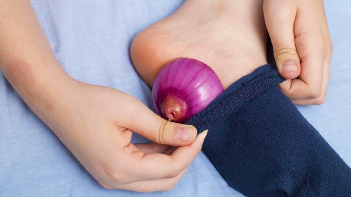 cipolle nei calzini per alleviare i vostri mali