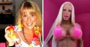 chirurgia per diventare una Barbie vivente