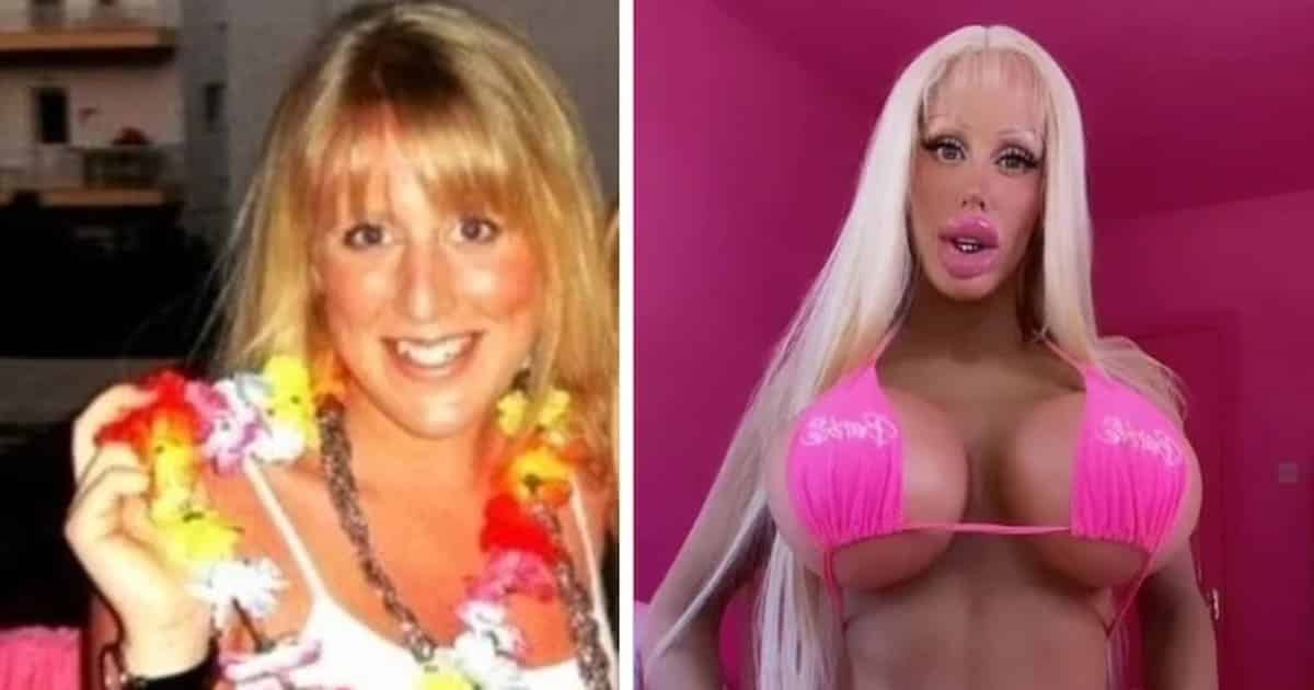 chirurgia per diventare una Barbie vivente